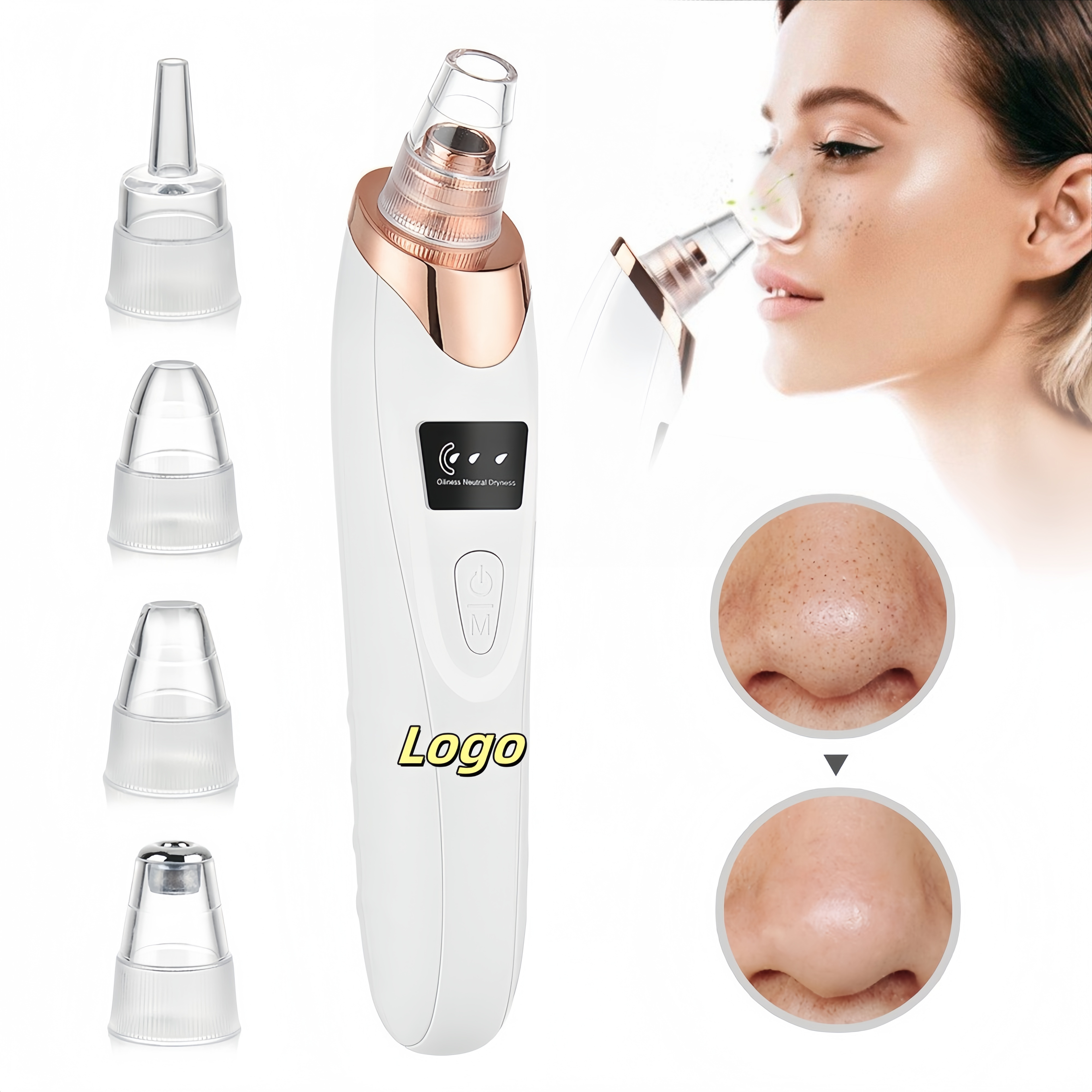 Electric Blackhead & Acne Vacuum Suction Device
